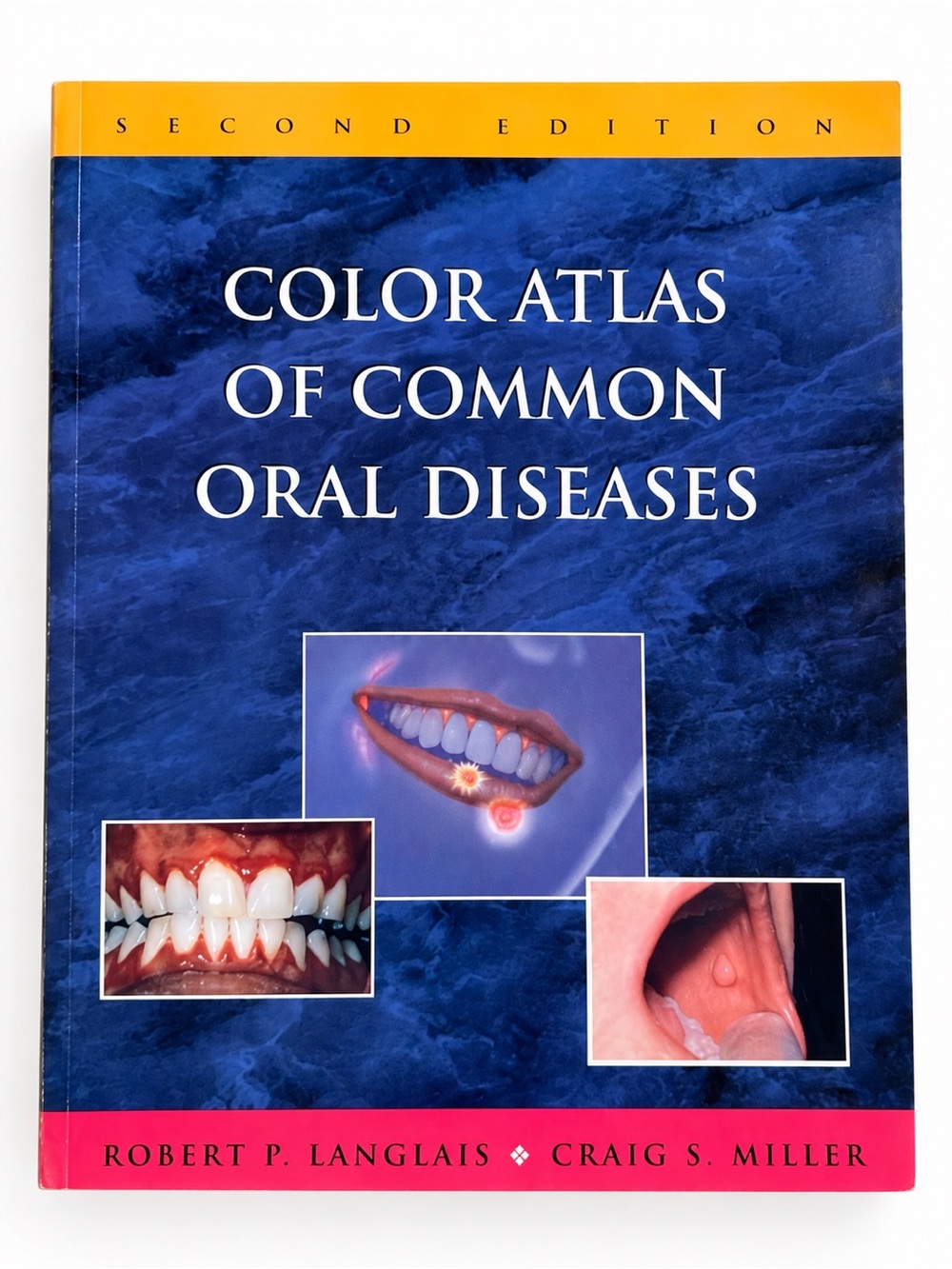 Color Atlas of Common Oral Diseases 2nd Edition Dental Textbook Langlais Miller